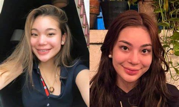 Before And After Plastic Surgery On Kitty Duterte: A New Look And Transformation
