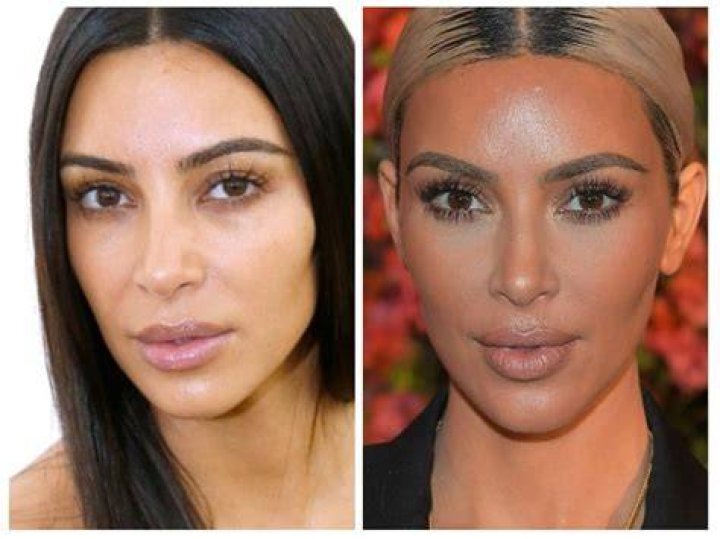 Kim Hieora | Done Plastic Surgery? Before And After Photo