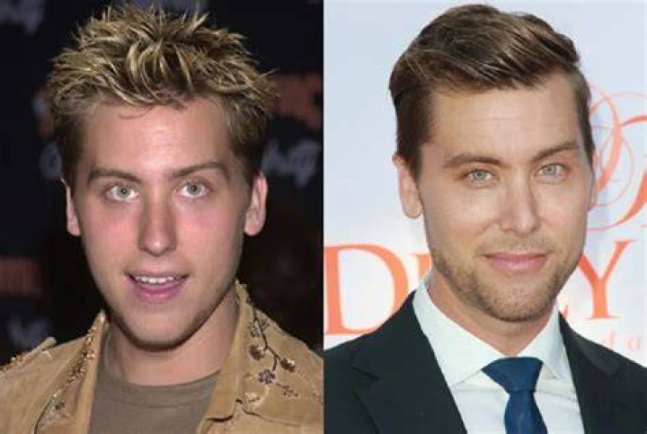Lance Bass Plastic Surgery | Before And After Photos